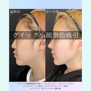 ルラ美容クリニック 札幌院 佐藤 雄紀医師の症例