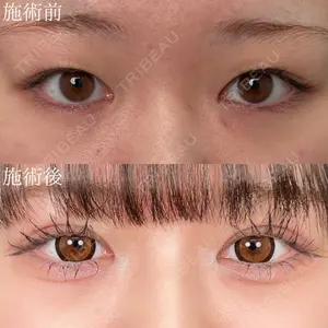症例