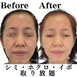 Mavie Beauty Clinic （マヴィービューティークリニック）の症例