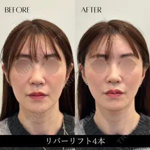 RIVER CLINIC（リバークリニック） 戸田 貴之医師の症例