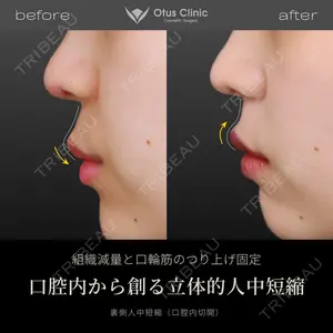Otus Clinic 【オータスクリニック】 中 徳太郎医師の症例