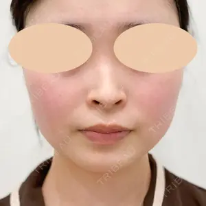 A CLINIC（エークリニック） 横浜院の症例
