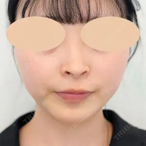 A CLINIC（エークリニック） 横浜院の症例