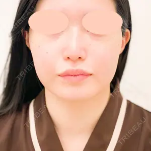 A CLINIC（エークリニック） 横浜院の症例