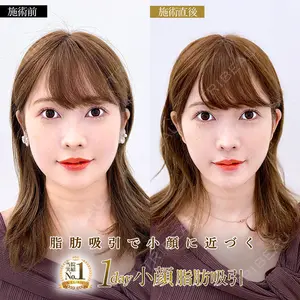 A CLINIC（エークリニック） 横浜院 柴田 貴志医師の症例