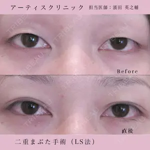 症例