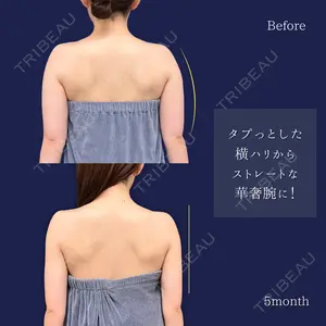 東京シンデレラ美容外科 新宿院の症例