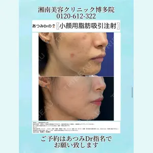 症例