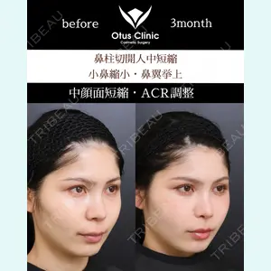 Otus Clinic 【オータスクリニック】 中 徳太郎医師の症例
