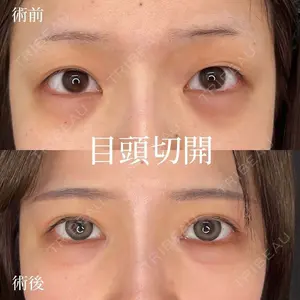 症例