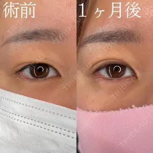 HAAB×DREAM BEAUTY CLINIC 大阪梅田院 柏木 太雅医師の症例