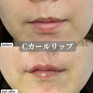 ルラ美容クリニック 神戸院の症例