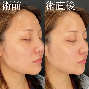 HAAB×DREAM BEAUTY CLINIC 大阪梅田院 柏木 太雅医師の症例
