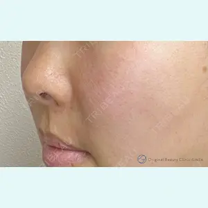 Original Beauty Clinic GINZA 佐藤玲史医師の症例