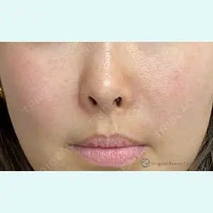 Original Beauty Clinic GINZA 佐藤玲史医師の症例