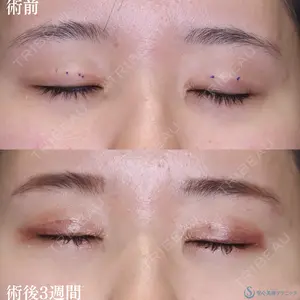 症例