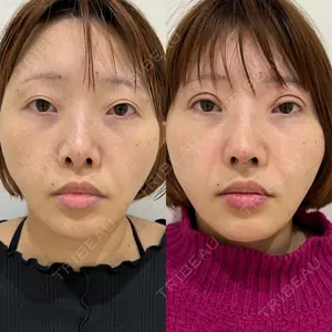 エターナル美容クリニック 久門田 詳医師の症例