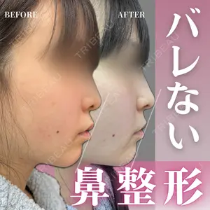 症例