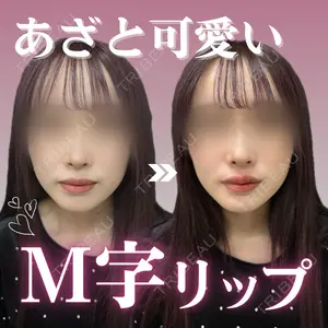 症例