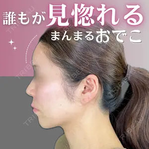 症例
