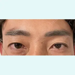脱毛クリニック麒麟の症例