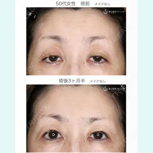 聖心美容クリニック 札幌院 前多 一彦医師の症例