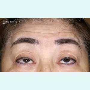 聖心美容クリニック 札幌院 前多 一彦医師の症例