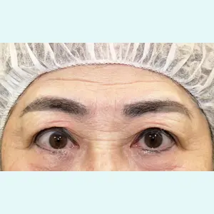 聖心美容クリニック 札幌院 前多 一彦医師の症例