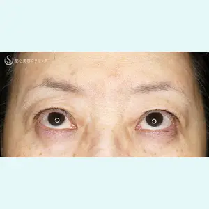聖心美容クリニック 札幌院 前多 一彦医師の症例