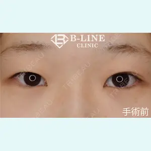 B-LINE CLINIC 池袋院 小池 康弘医師の症例