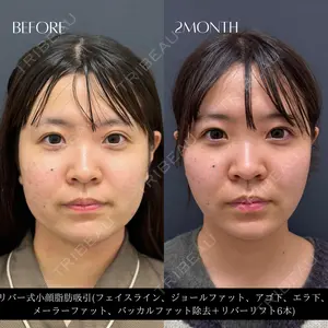 RIVER CLINIC（リバークリニック） 戸田 貴之医師の症例