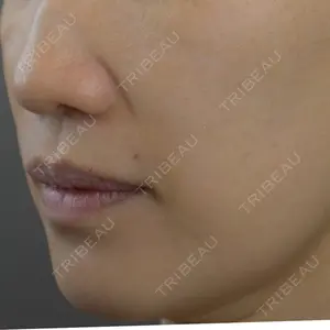症例