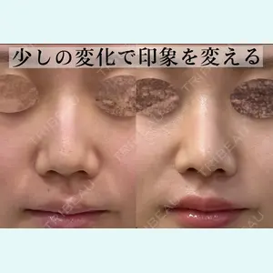 症例