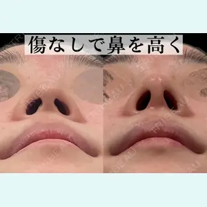 症例