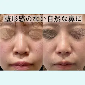 症例