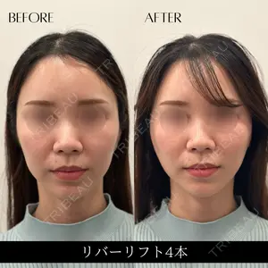 RIVER CLINIC（リバークリニック） 戸田 貴之医師の症例