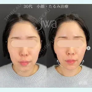 症例