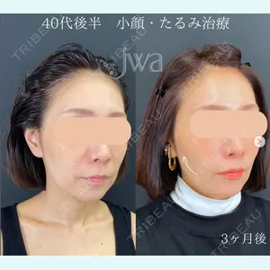 自由が丘ウェルエイジングビューティークリニックの症例