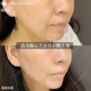症例