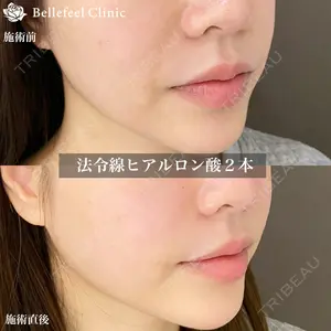 症例