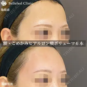 Bellefeel Clinic 代官山 兵藤 秀忠 医師の症例