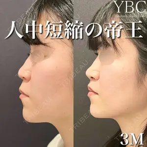 YBC横浜美容外科 大宮院 磯村 亮輔医師の症例