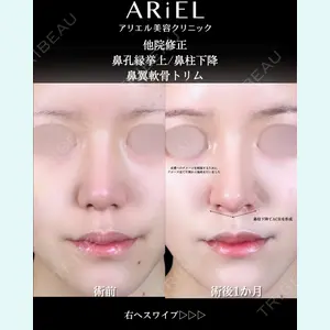 アリエル美容クリニック 大宮院 阪野 一世医師の症例