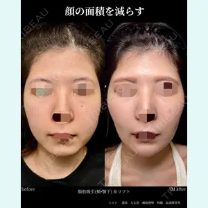 グローバルビューティークリニック 大阪院の症例