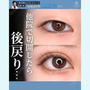 東京シンデレラ美容外科 新宿院 吉原 伯医師の症例