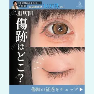 東京シンデレラ美容外科 新宿院 吉原 伯医師の症例