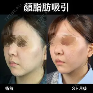 ルラ美容クリニック 新宿院 陶 美梨医師の症例
