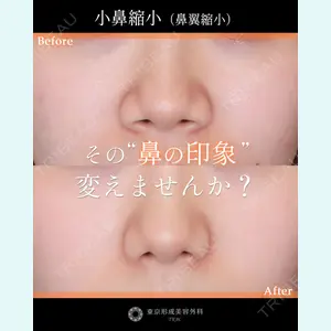 東京形成美容外科 船橋院 山田 大輔医師の症例