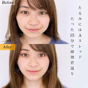 A CLINIC（エークリニック） 横浜院 柴田 貴志医師の症例