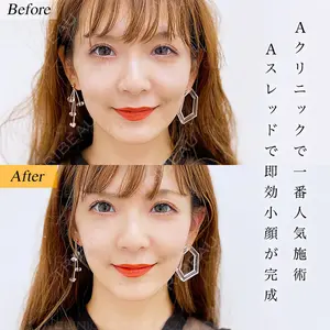 A CLINIC（エークリニック） 横浜院 柴田 貴志医師の症例